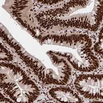 Atlas Antibodies Anti-CNKSR3 Antibody