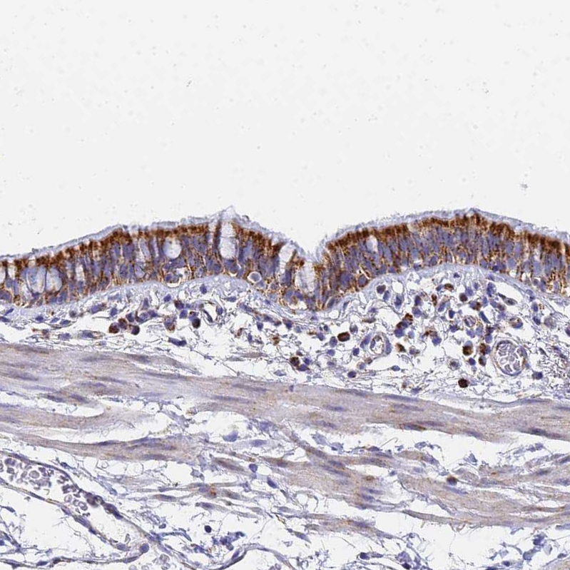 Atlas Antibodies Anti-CNIH4 Antibody