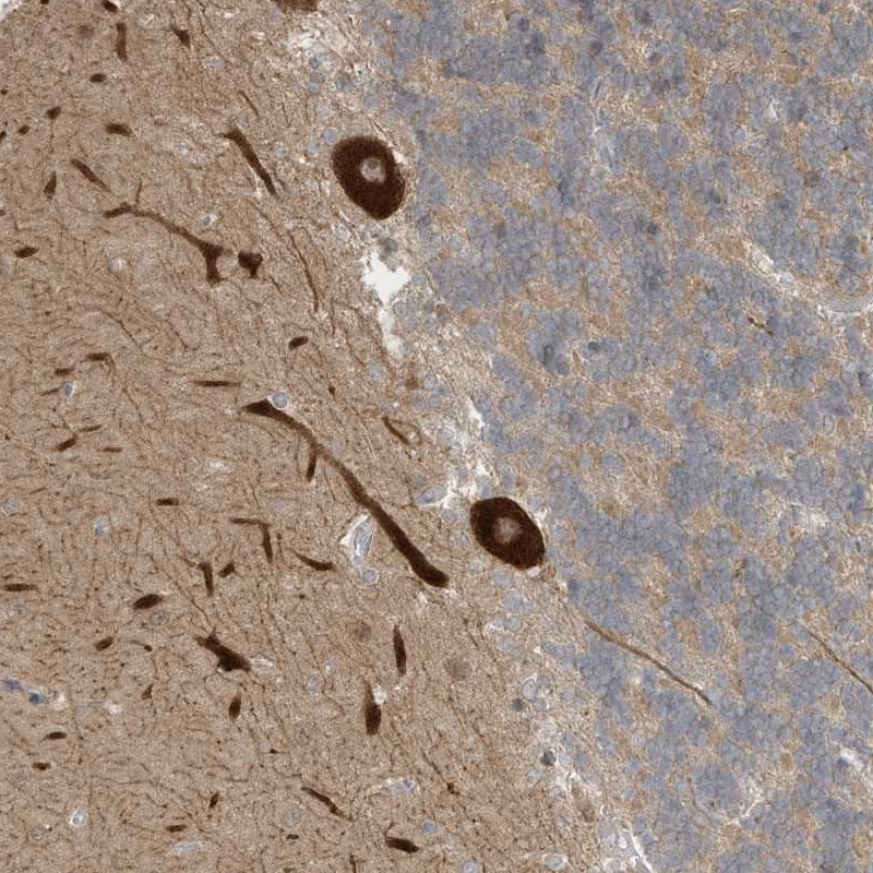 Atlas Antibodies Anti-CNKSR1 Antibody
