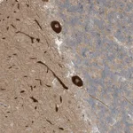 Atlas Antibodies Anti-CNKSR1 Antibody