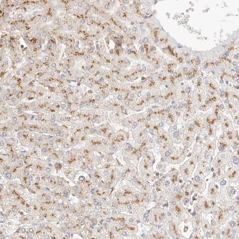Atlas Antibodies Anti-CNMD Antibody