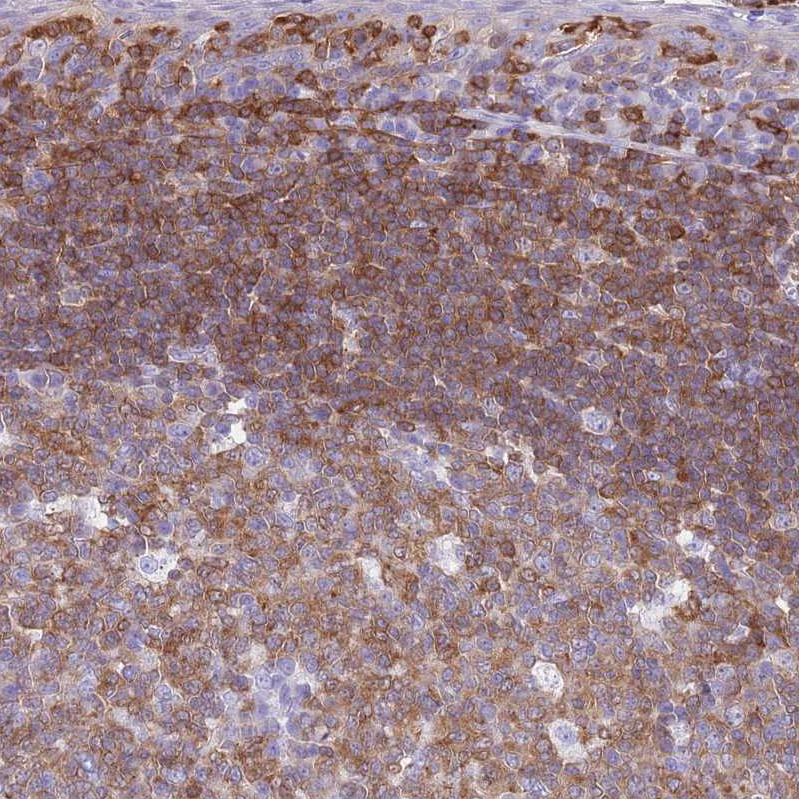 Atlas Antibodies Anti-CNN2 Antibody