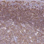 Atlas Antibodies Anti-CNN2 Antibody