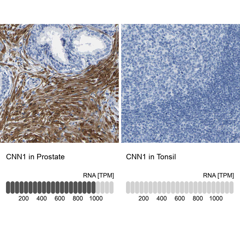 Atlas Antibodies Anti-CNN1 Antibody