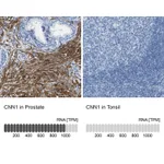 Atlas Antibodies Anti-CNN1 Antibody