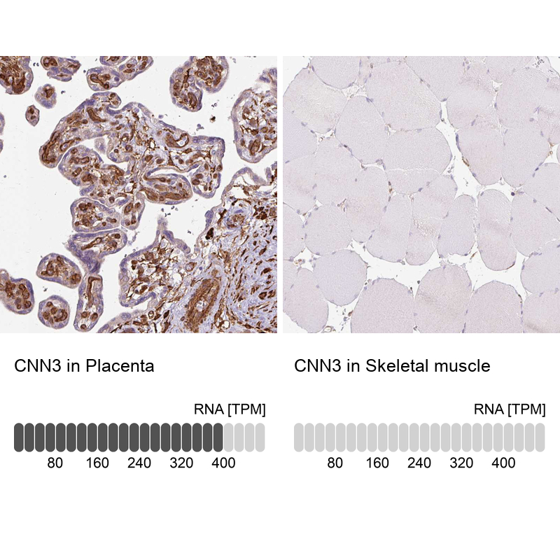 Atlas Antibodies Anti-CNN3 Antibody