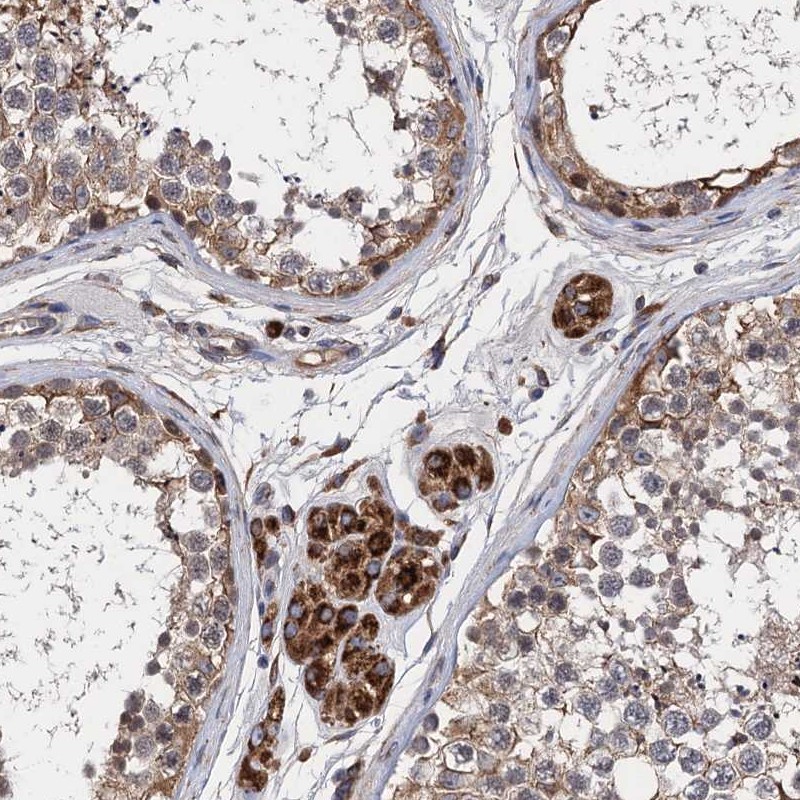 Atlas Antibodies Anti-CNNM1 Antibody