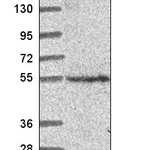 Atlas Antibodies Anti-CNNM2 Antibody