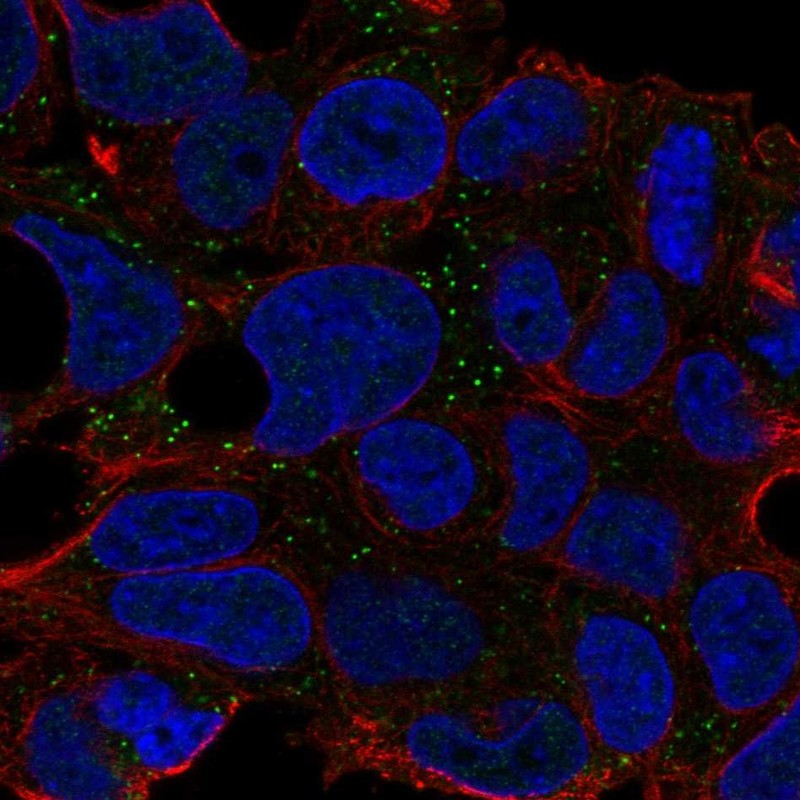Atlas Antibodies Anti-CNNM2 Antibody