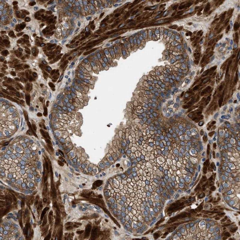 Atlas Antibodies Anti-CNNM3 Antibody