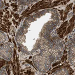 Atlas Antibodies Anti-CNNM3 Antibody