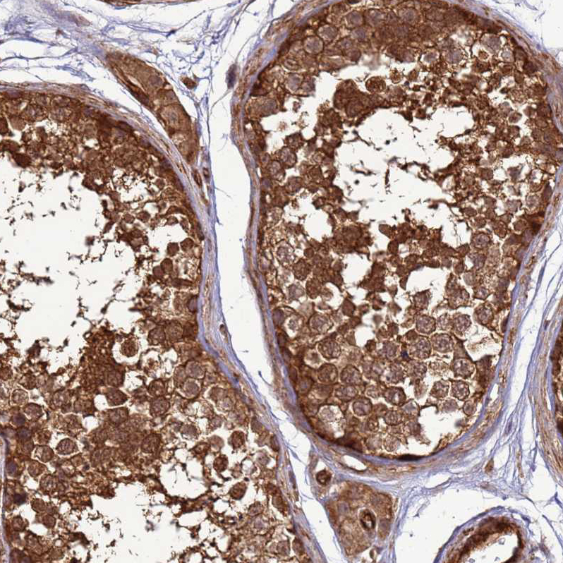 Atlas Antibodies Anti-CNOT1 Antibody