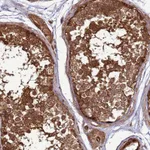 Atlas Antibodies Anti-CNOT1 Antibody