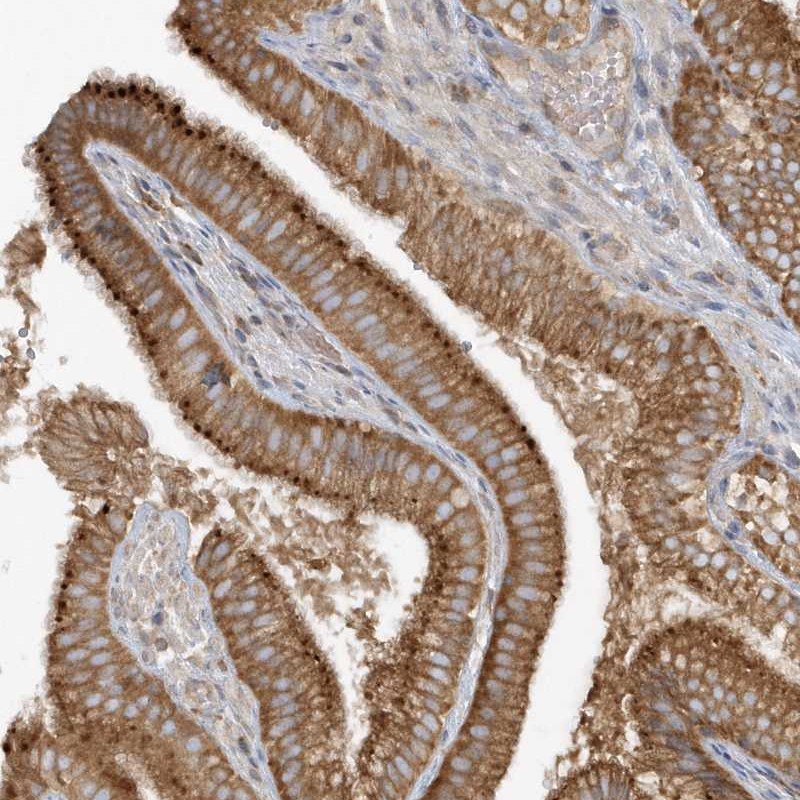 Atlas Antibodies Anti-CNOT10 Antibody