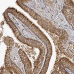 Atlas Antibodies Anti-CNOT10 Antibody
