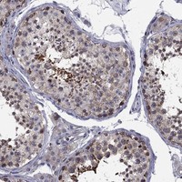 Atlas Antibodies Anti-CNOT11 Antibody