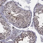 Atlas Antibodies Anti-CNOT11 Antibody