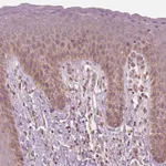 Atlas Antibodies Anti-CNOT2 Antibody
