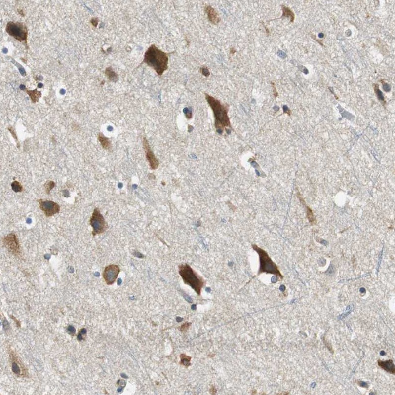Atlas Antibodies Anti-CNOT3 Antibody