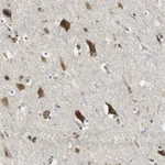 Atlas Antibodies Anti-CNOT3 Antibody