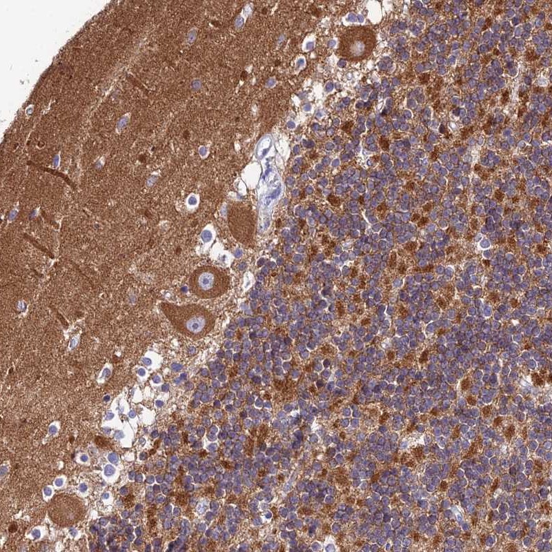 Atlas Antibodies Anti-CNOT6 Antibody