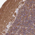 Atlas Antibodies Anti-CNOT6 Antibody