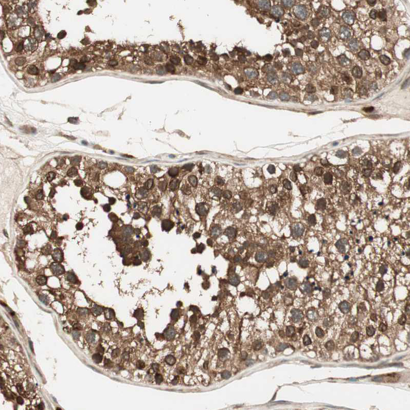 Atlas Antibodies Anti-CNOT4 Antibody