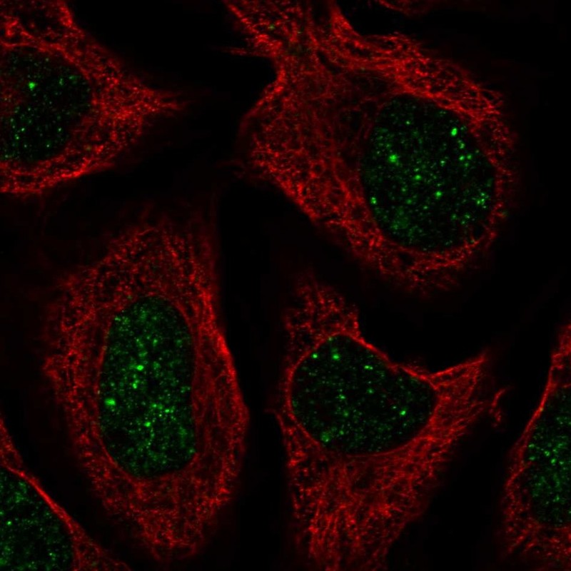 Atlas Antibodies Anti-CNOT7 Antibody