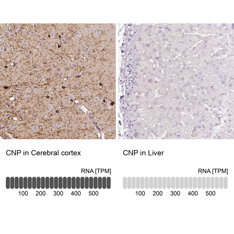 Atlas Antibodies Anti-CNP Antibody
