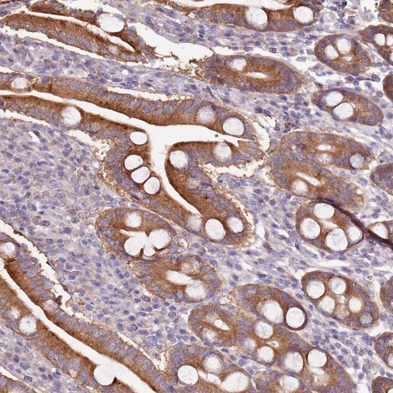 Atlas Antibodies Anti-CNOT9 Antibody