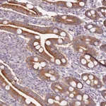 Atlas Antibodies Anti-CNOT9 Antibody