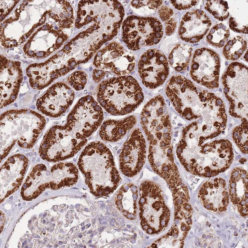 Atlas Antibodies Anti-CNOT8 Antibody