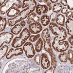 Atlas Antibodies Anti-CNOT8 Antibody