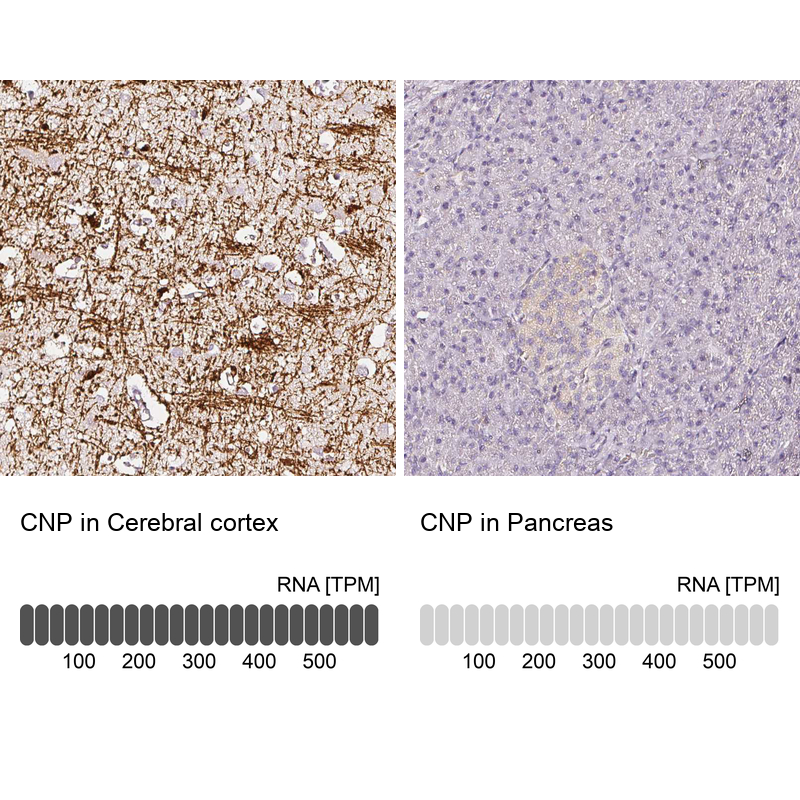 Atlas Antibodies Anti-CNP Antibody