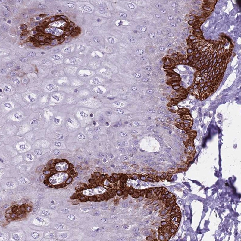 Atlas Antibodies Anti-CNPPD1 Antibody