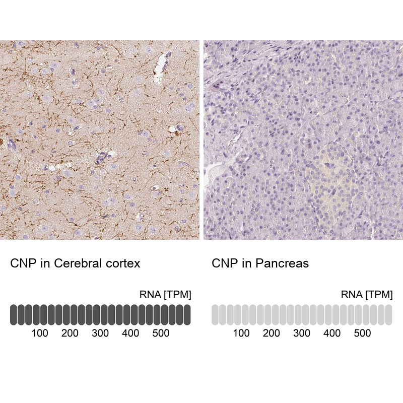 Atlas Antibodies Anti-CNP Antibody