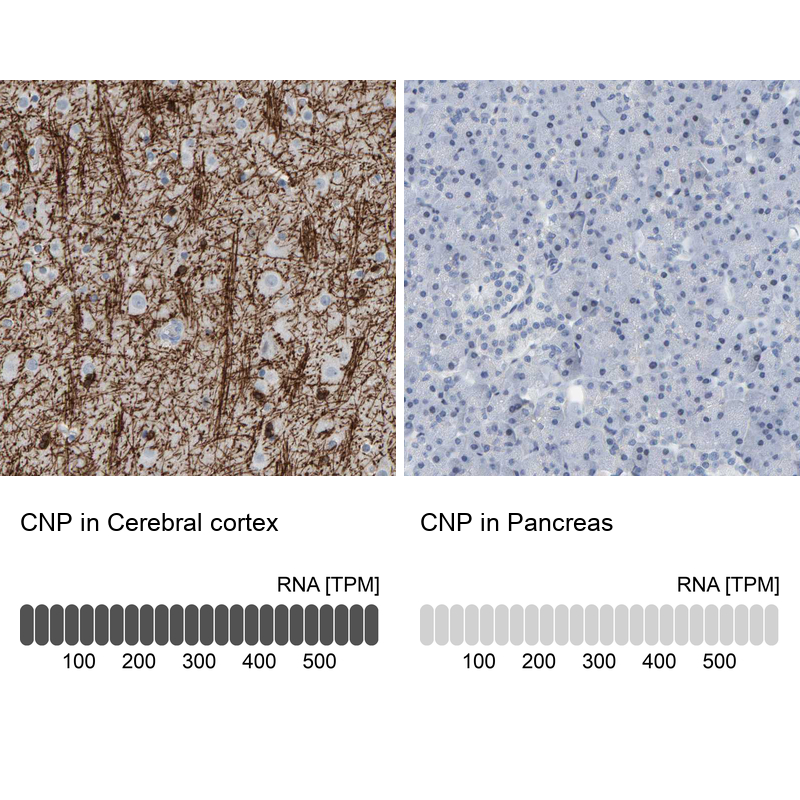 Atlas Antibodies Anti-CNP Antibody