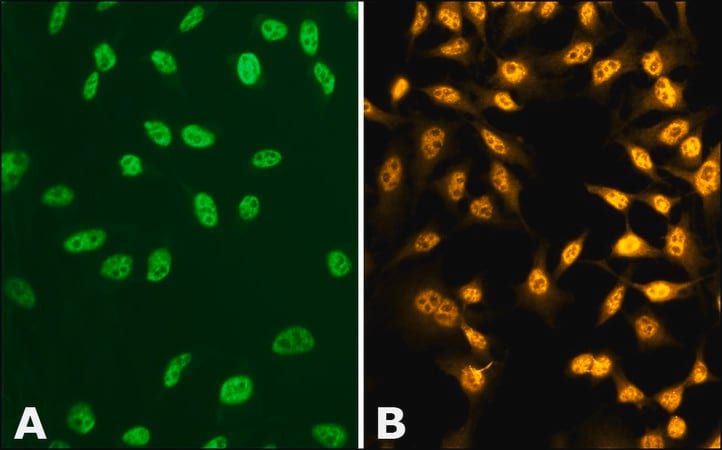 Merck Anti-phospho-TDP-43 (pSer410) antibody produced in rabbit