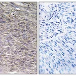 Merck Anti-CHSY2, C-Terminal antibody produced in rabbit