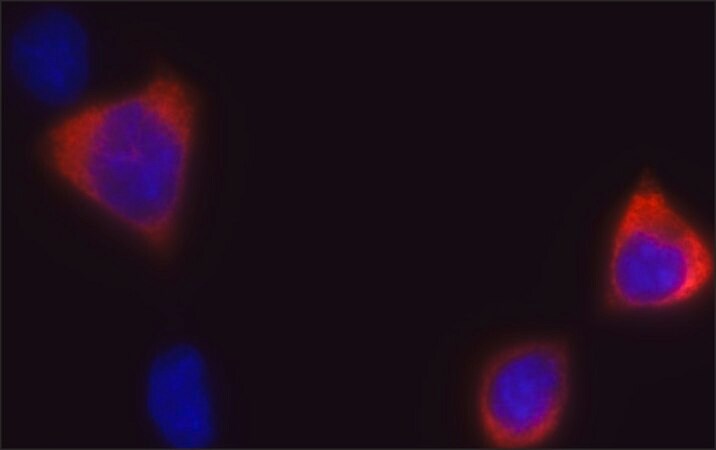 Merck Anti-CRISPR/Cas9 (C-terminal) antibody, Mouse monoclonal