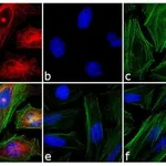 Thermo Fisher Scientific Goat anti-Mouse IgG1 Cross-Adsorbed Secondary Antibody, Alexa Fluor 555