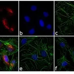 Thermo Fisher Scientific Donkey anti-Rabbit IgG (H+L) Highly Cross-Adsorbed Secondary Antibody, Alexa Fluor 546