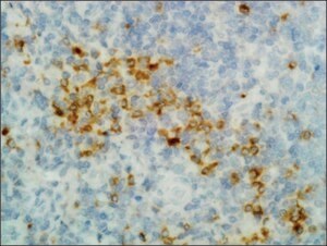 Merck ANTI-HUMAN GAMMA HEAVY CHAIN ANTIBODY, R