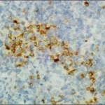 Merck ANTI-HUMAN GAMMA HEAVY CHAIN ANTIBODY, R