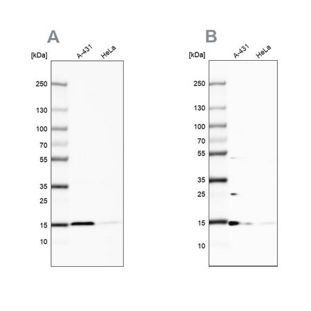 Merck Anti-CCDC58 antibody produced in rabbit