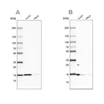 Merck Anti-CCDC58 antibody produced in rabbit