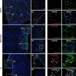 Thermo Fisher Scientific Donkey anti-Rabbit IgG (H+L) Highly Cross-Adsorbed Secondary Antibody, Alexa Fluor 555
