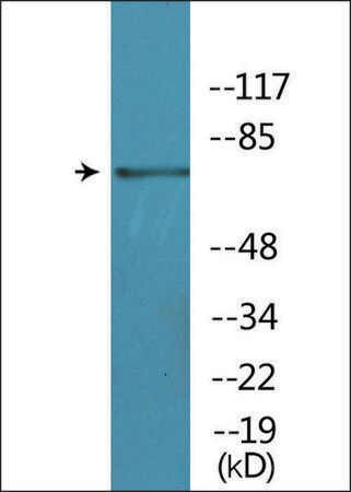 Merck Anti-phospho-BTK (pTyr551) antibody produced in rabbit