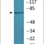 Merck Anti-phospho-BTK (pTyr551) antibody produced in rabbit