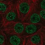 Merck Anti-ZBTB9 antibody produced in rabbit